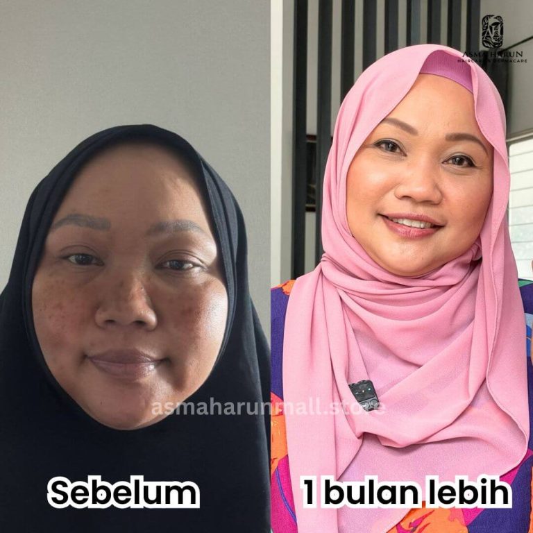 Kak Emma